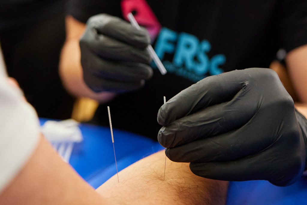 joint-mobilization-technique